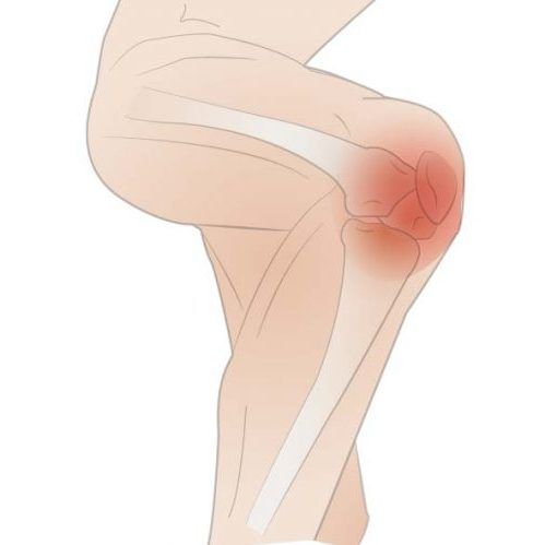 knee pain
