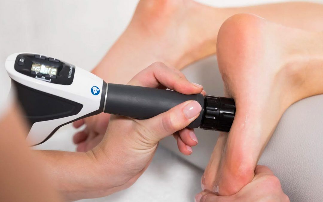 Shockwave Therapy Benefits in Podiatry for Heel Pain, Plantar Fasciitis and other Lower Limb Issues